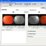 EyeMD EMR Software EHR and Practice Management Software