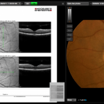 myCare EHR Suite by Eye Care Leaders EHR and Practice Management Software