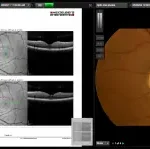 myCare EHR Suite by Eye Care Leaders EHR and Practice Management Software