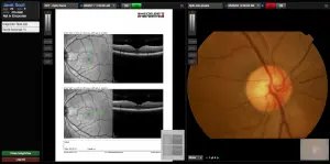 myCare EHR Suite by Eye Care Leaders EHR and Practice Management Software