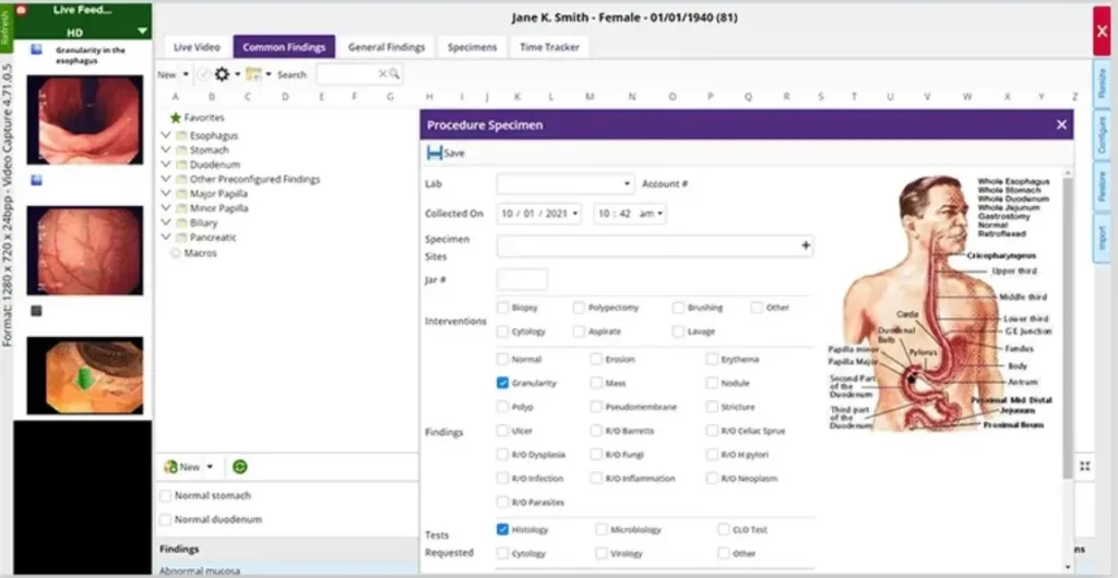 gGastro EHR & Endoscopy Report Writer Software EHR and Practice Management Software