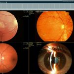 VEPRO Picture Archiving and Communication System EHR and Practice Management Software