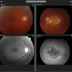 IntelleChart EHR Software EHR and Practice Management Software