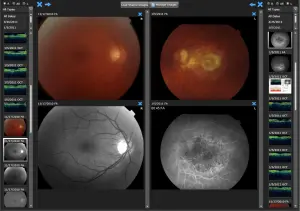 IntelleChart-EMR-and-practice-management-software-demo