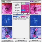 Eyecom3 EMR Software EHR and Practice Management Software