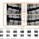 Curve Dental EMR Software EHR and Practice Management Software