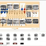 Curve Dental EMR Software EHR and Practice Management Software