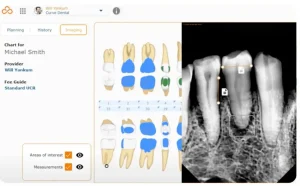 Curve-Dental-EMR-Practice-Management-Software-Imaging
