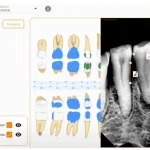 Curve Dental EMR Software EHR and Practice Management Software