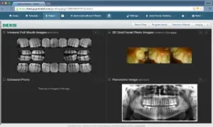 Dentrix Ascend Software EHR Software Demo