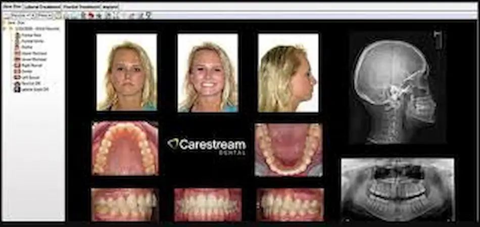 Carestream Dental EMR Software EHR and Practice Management Software