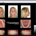 Carestream Dental EMR Software EHR and Practice Management Software