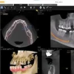 Carestream Dental EMR Software EHR and Practice Management Software