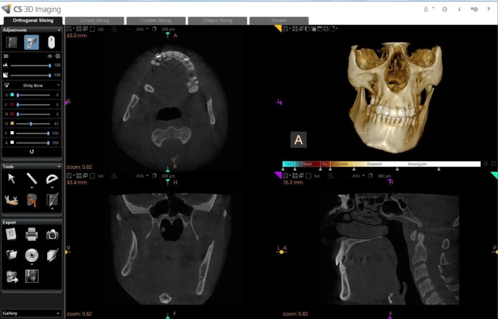 Carestream Dental EMR Software EHR and Practice Management Software