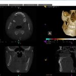 Carestream Dental EMR Software EHR and Practice Management Software