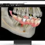 Carestream Dental EMR Software EHR and Practice Management Software