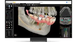 Carestream Dental EMR Software EHR and Practice Management Software