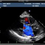 UltraLinq EMR Software EHR and Practice Management Software