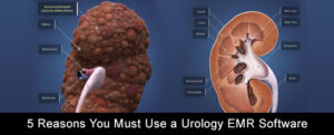 5 Reasons You Must Use a Urology EMR Software
