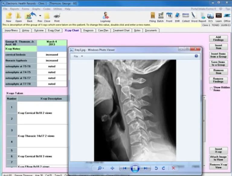 EZBIS Office EMR Practice Management Software Key Chart