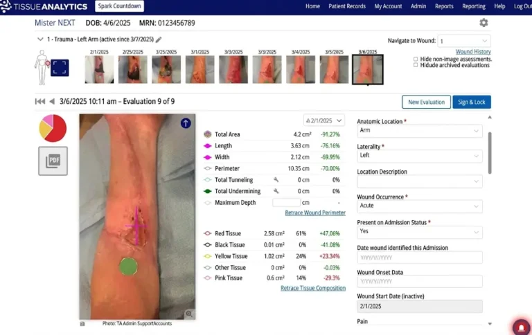 Net Health ReDoc Tissue Analytics EMR software demo