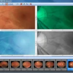 Acuitas ActivEHR 2.0 EMR Software EHR and Practice Management Software