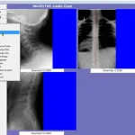 Atlas Chiropractic EMR Software EHR and Practice Management Software