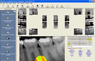 Eaglesoft Dental Practice Management Software EHR and Practice Management Software