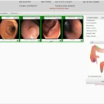 EndoVault - Endoscopy EHR & EMR Software EHR and Practice Management Software