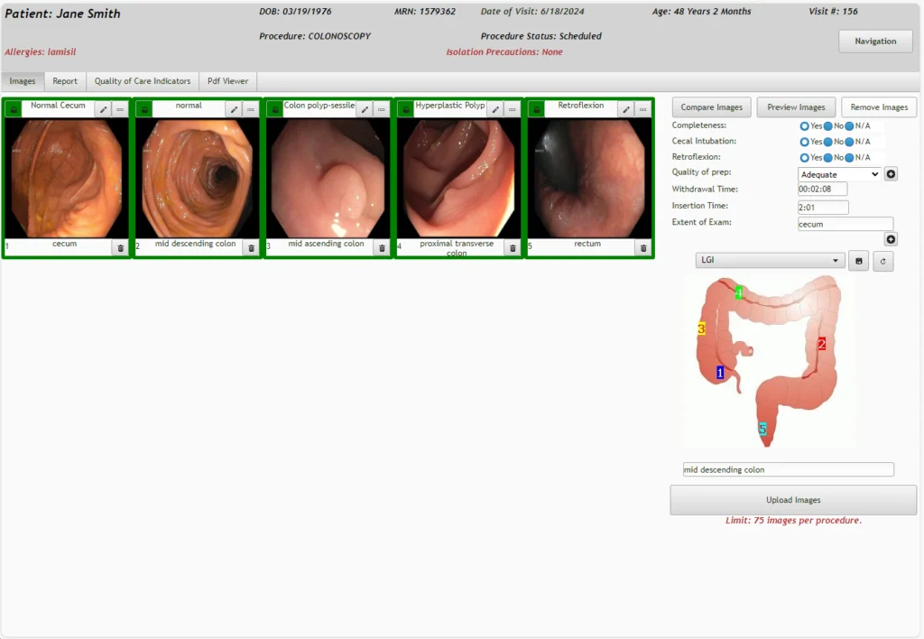 EndoVault - Endoscopy EHR & EMR Software EHR and Practice Management Software