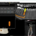 Carestream Dental EMR Software EHR and Practice Management Software